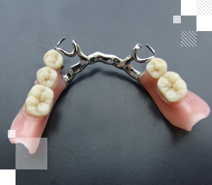 Бюгельный протез установка в Киеве