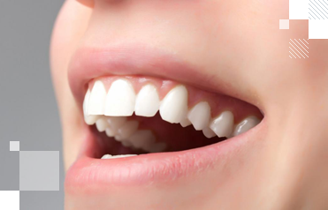 Пресскерамические коронки