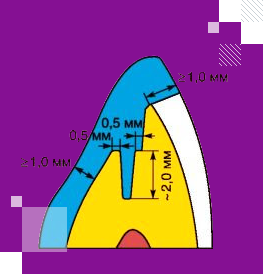 Пинлей вкладки