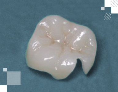 Керамика идентична зубной эмали