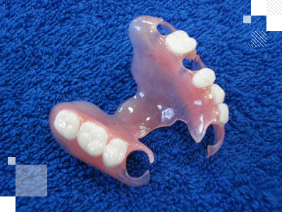 Протез нейлоновый съемный