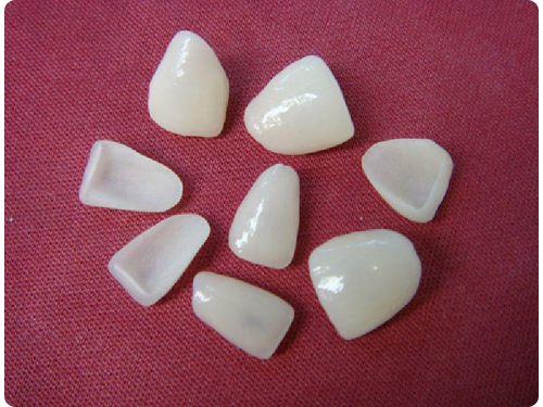 Прямая реставрация