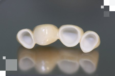 Циркониевые коронки в Киеве недорого